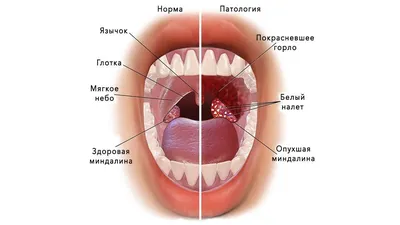 2. Подробные изображения миндалин: выберите формат и размер