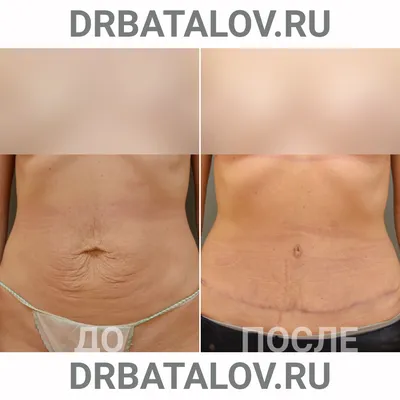 17) Фото тату с выбором формата и размера для загрузки