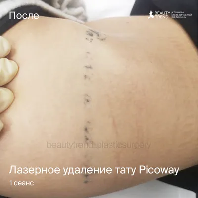 20) Фото тату с закругленными углами в формате webp