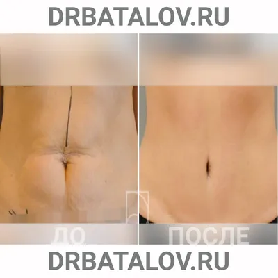 27) Картинка тату с разнообразными форматами и размерами для скачивания