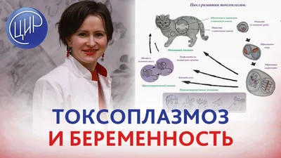 Изображения токсоплазмоза человека: Варианты форматов для загрузки