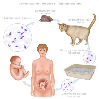 Изображения токсоплазмоза человека: Разные форматы для загрузки