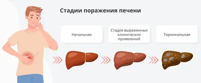 Уникальный снимок цирроза печени: JPG, WebP – выберите свой формат