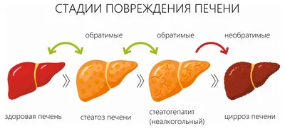 Выберите изображение цирроза печени: JPG, PNG, WebP – на ваш выбор