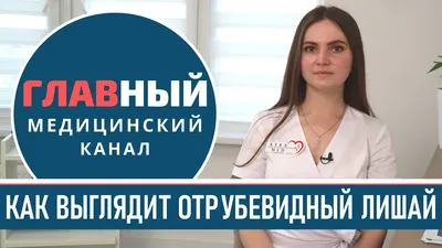 Фотографии Цветного лишая: Выбирайте изображения по своему вкусу