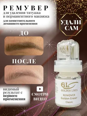 Удаление тату ремувером: скачайте картинку в формате jpg