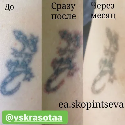 Удаление тату: выбор размера изображения и формата для скачивания