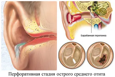 Ухо человека в WebP: Сжатие без потери качества