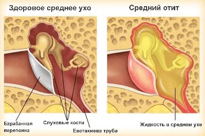 Изображение уха: Размер на выбор