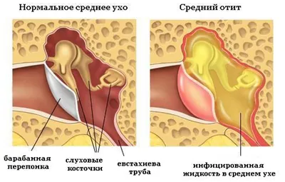 Фотка уха: Захватывающий момент в каждом формате