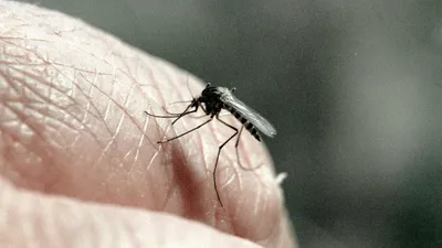 Укус комара аллергия фотографии