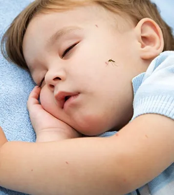 Укус комара ребенка: фото и симптомы аллергии