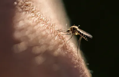 Фото укуса комара ребенка: как предотвратить инфекцию