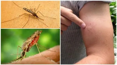 Укус малярийного комара: фотографии в дикой природе