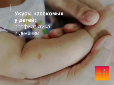 Укус муравья: уникальные снимки муравьев, которые вызовут у вас восхищение