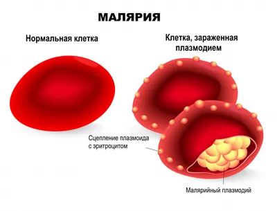 Укусы комаров у младенцев: фото и средства от укусов