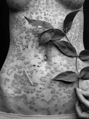 Фотка: Черная роза с венерической болезнью в формате jpg, среднего размера
