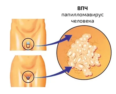 Фото ВПЧ: выбор размера, формат (JPG, PNG, WebP)