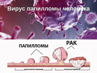 Фото вируса папилломы человека: выбор размера и формата изображения