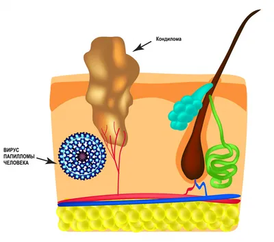 Фото вируса папиломы человека: разнообразие форматов изображения
