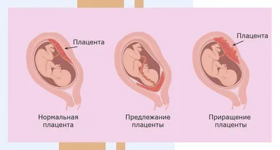 Моменты Создания: Фото Фаз Развития в Различных Разрешениях