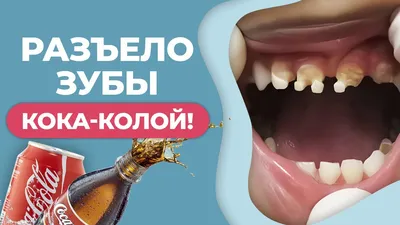 Изображение: последствия употребления Кока-Колы для пищеварительной системы