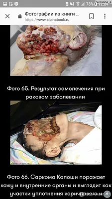 Фотографии и картинки: Вскрытие человека