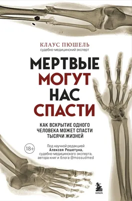 Свежие фото для загрузки: Вскрытие человека