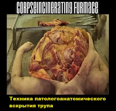 Подробные снимки: Фотографии Вскрытия человека