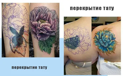 Полное удаление тату: фотография с процессом выведения