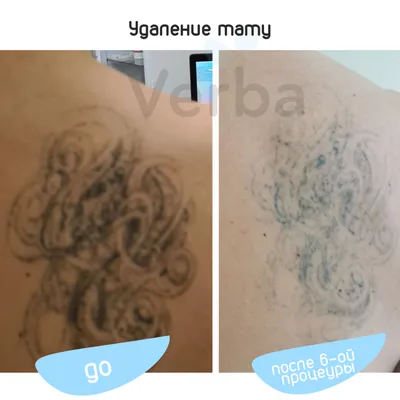 Фото либо: выведенная татуировка пейзажа на спине, формат webp