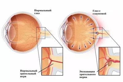 Глазные патологии: Выберите формат скачивания