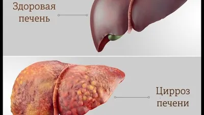 Изысканные изображения человеческой печени: разнообразие размеров