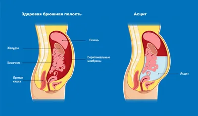 Здоровая печень в картинках: форматы (JPG, PNG, WebP) на ваш выбор