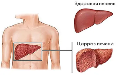 Фотографии здоровой печени человека: выберите размер и формат