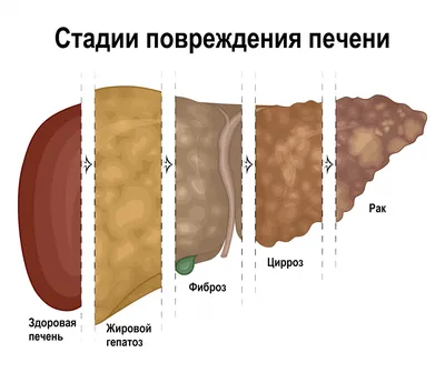 Здоровая печень в картинках: выберите формат скачивания (JPG, PNG, WebP)