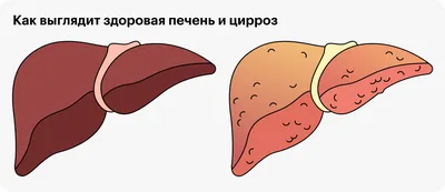 Здоровая печень человека: красивые фотографии для скачивания