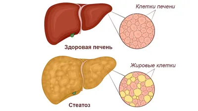 Фотографии печени: форматы (JPG, PNG, WebP) и размеры по вашему желанию