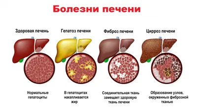 Фотографии Желчи: Скачивайте ваши любимые в формате по выбору