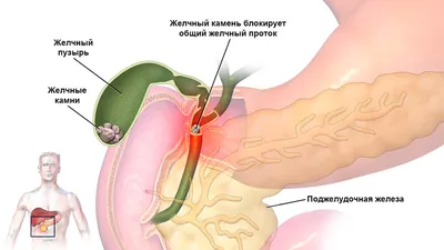 Уникальные кадры: Желчь Человека в различных ракурсах