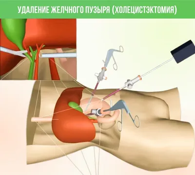 Фотография Желчного Пузыря: Загрузите в WebP для Быстрой Загрузки