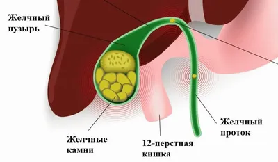 Изображение Желчного Пузыря Человека: Форматы для Всех Вкусов