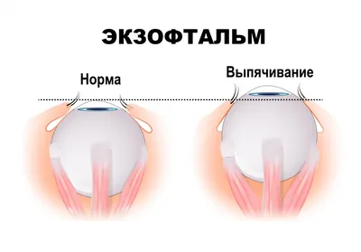 Изысканные изображения: Фотографии зоба в разных стилях