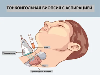 Зоб на изображениях: Картинки для загрузки в JPG, PNG, WebP