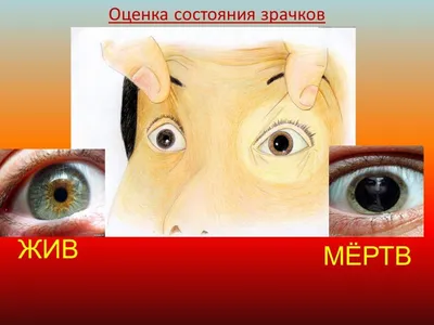 Мрак и загадка: Зрачки мертвого человека в высоком разрешении